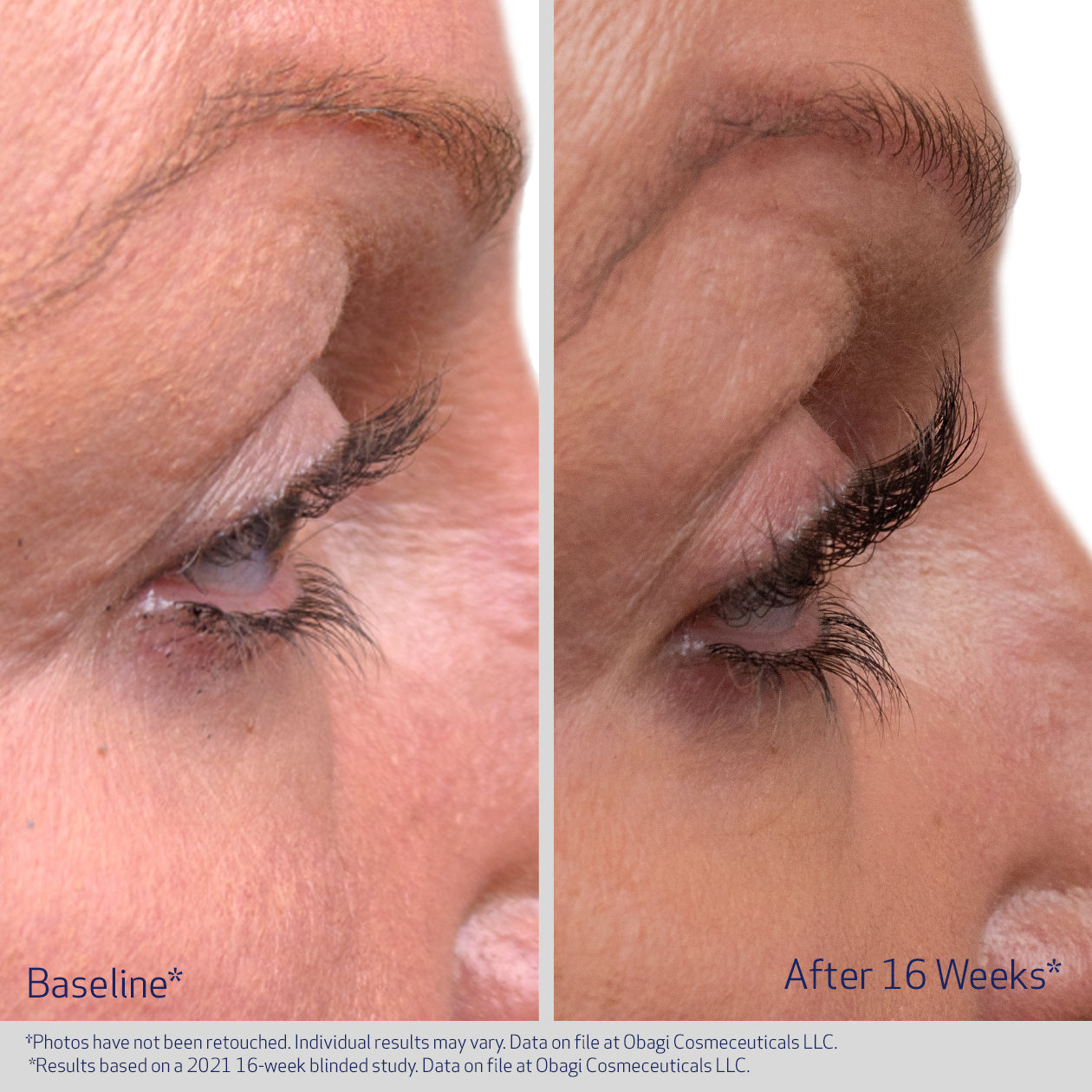 Obagi Nu-Cil Eyelash Enhancing Serum